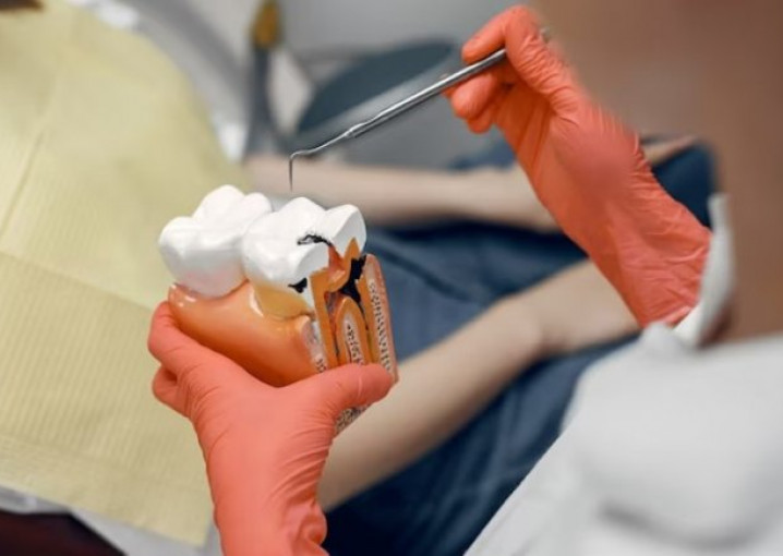 Реставрация зубов: Рекомендации от профессионалов для тех, кто интересуется услугой